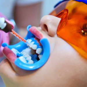 konyadisbeyazlatmatedavisi