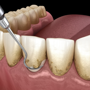 konyadistasitemizliği
