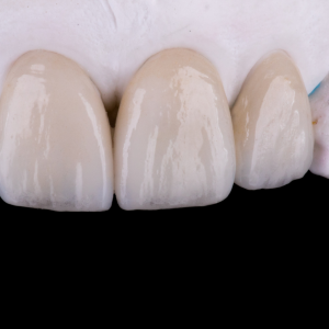 konyalaminediskaplama