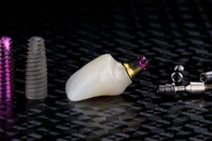 All-on-4 ve All-on-6 implant tedavisinde sabit protezlerin çene kemiğine yerleşimini gösteren görsel.