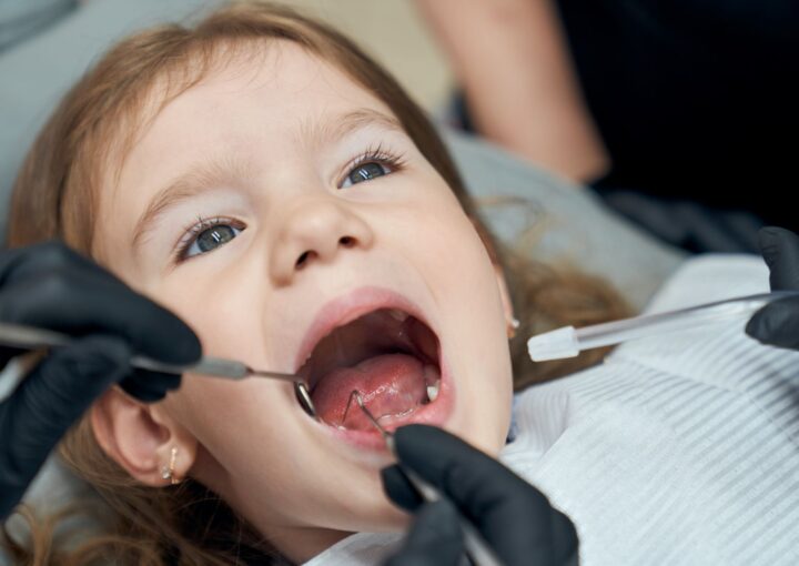 Çocuklarda süt dişi çürüklerini ve ağız bakımını gösteren bilgilendirici görsel.