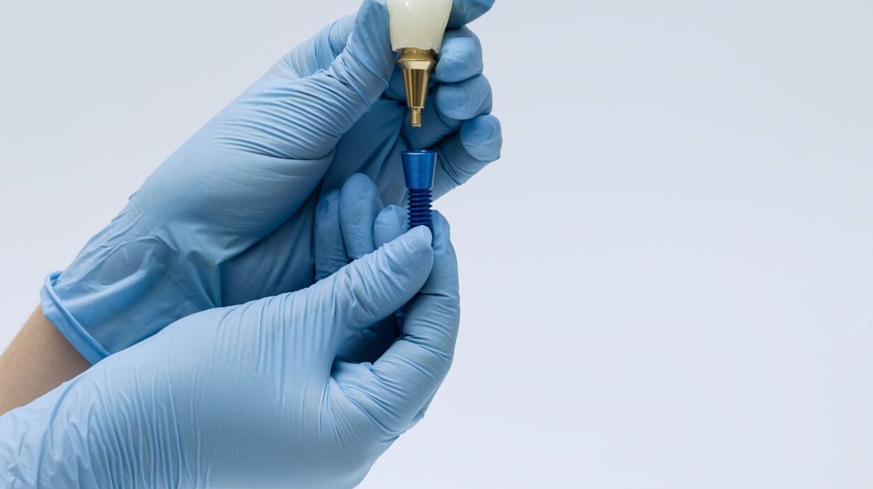 Çene kemiğine yerleştirilen dental implant ve implant üstü protez aşamalarını gösteren bilgilendirici görsel.