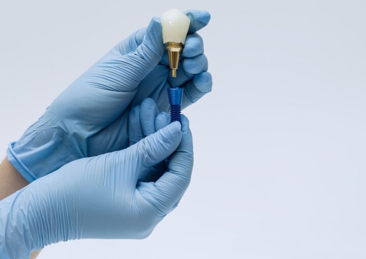 Çene kemiğine yerleştirilen dental implant ve implant üstü protez aşamalarını gösteren bilgilendirici görsel.