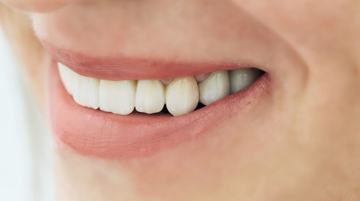 zirkonyum-kaplama-mi-porselen-kaplama-mi