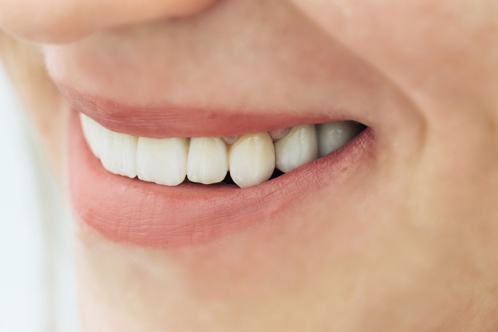 zirkonyum-kaplama-mi-porselen-kaplama-mi