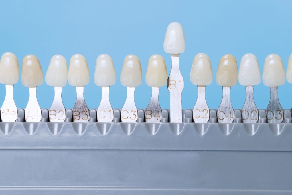 Konya porselen diş kaplama uygulaması için ön dişlerde estetik değerlendirme