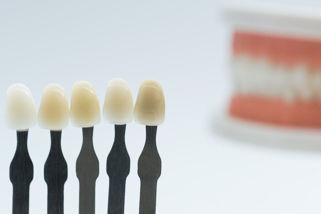 Konya porselen diş restorasyonu sonrası doğal görünümlü diş kaplama örneği