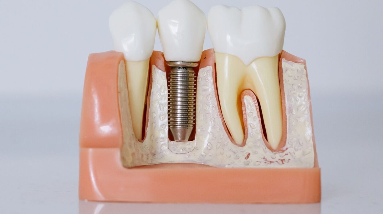 Diş implantı çevresindeki diş eti ve destek dokuların rutin kontrol sırasında değerlendirildiği diş hekimliği muayenesi.
