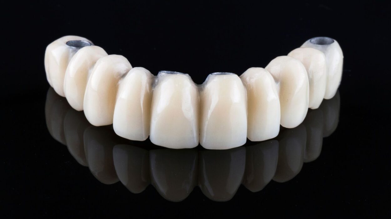 İmplant üstü protez planlamasında ağız yapısı, implant konumları ve kapanış ilişkisinin değerlendirildiği diş hekimliği muayenesi.