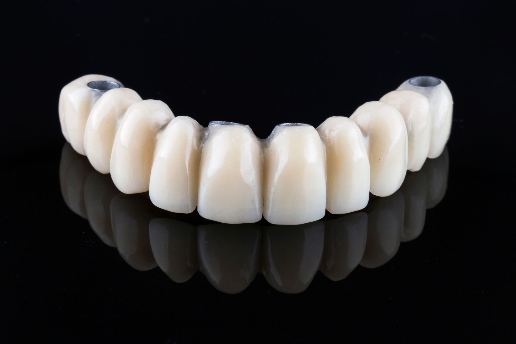 İmplant üstü protez planlamasında ağız yapısı, implant konumları ve kapanış ilişkisinin değerlendirildiği diş hekimliği muayenesi.
