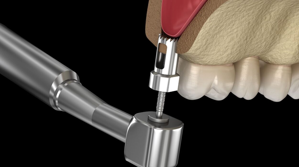 Üst çene arka bölgede implant öncesi kemik ve maksiller sinüs yapısının radyografik olarak değerlendirilmesi.